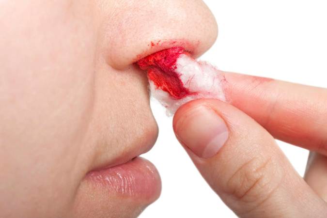 Как остановить кровушка из  носа: советы медиков