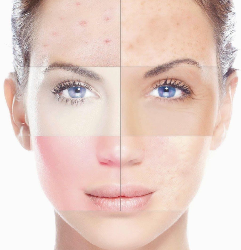 Как определить разряд кожи лица